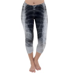 X Ray Capri Winter Leggings  by Valentinaart