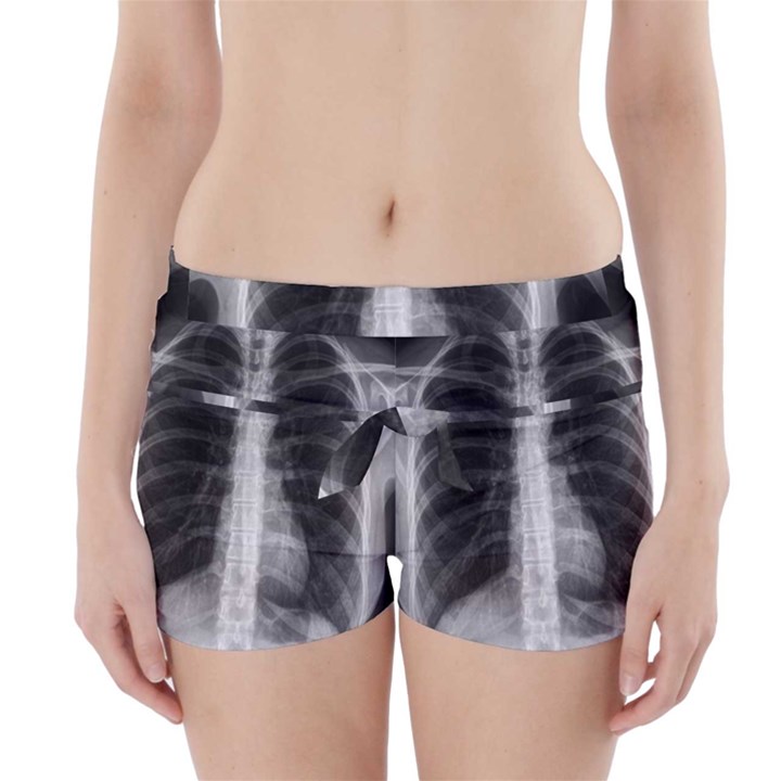 X Ray Boyleg Bikini Wrap Bottoms