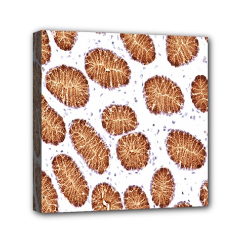 Formalin Paraffin Human Stomach Stained Bacteria Brown Mini Canvas 6  X 6  by Mariart