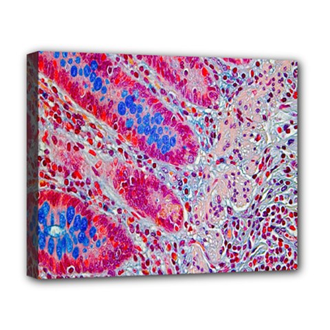 Histology Inc Histo Logistics Incorporated Alcian Blue Deluxe Canvas 20  X 16   by Mariart