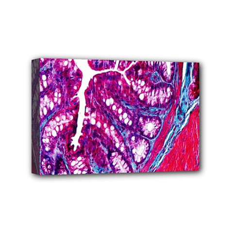 Histology Inc Histo Logistics Incorporated Masson s Trichrome Three Colour Staining Mini Canvas 6  X 4  by Mariart