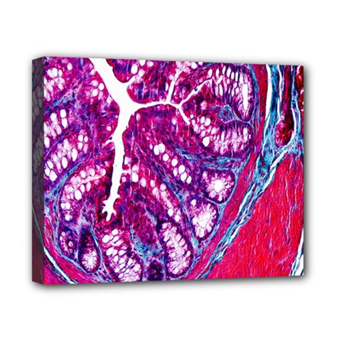 Histology Inc Histo Logistics Incorporated Masson s Trichrome Three Colour Staining Canvas 10  X 8  by Mariart