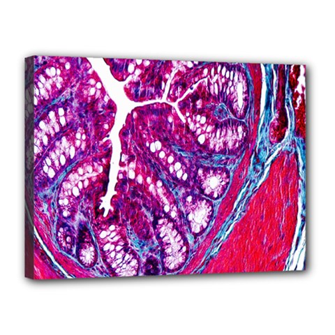 Histology Inc Histo Logistics Incorporated Masson s Trichrome Three Colour Staining Canvas 16  X 12  by Mariart