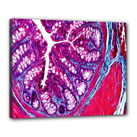 Histology Inc Histo Logistics Incorporated Masson s Trichrome Three Colour Staining Canvas 20  X 16  by Mariart