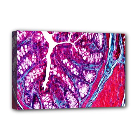 Histology Inc Histo Logistics Incorporated Masson s Trichrome Three Colour Staining Deluxe Canvas 18  X 12   by Mariart