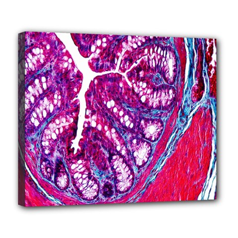 Histology Inc Histo Logistics Incorporated Masson s Trichrome Three Colour Staining Deluxe Canvas 24  X 20   by Mariart