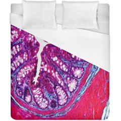 Histology Inc Histo Logistics Incorporated Masson s Trichrome Three Colour Staining Duvet Cover (california King Size) by Mariart