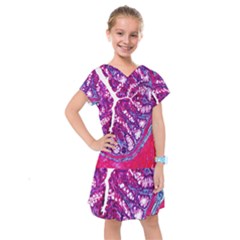 Histology Inc Histo Logistics Incorporated Masson s Trichrome Three Colour Staining Kids  Drop Waist Dress by Mariart