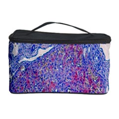 Histology Inc Histo Logistics Incorporated Human Liver Rhodanine Stain Copper Cosmetic Storage Case by Mariart