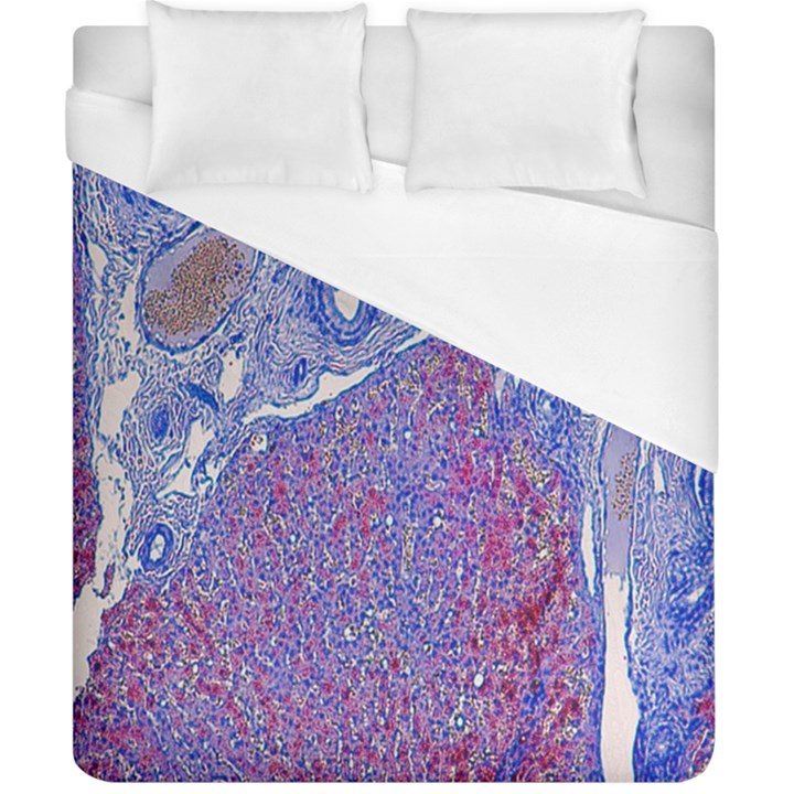 Histology Inc Histo Logistics Incorporated Human Liver Rhodanine Stain Copper Duvet Cover (California King Size)