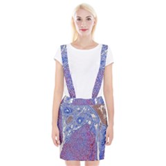 Histology Inc Histo Logistics Incorporated Human Liver Rhodanine Stain Copper Braces Suspender Skirt by Mariart