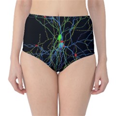 Synaptic Connections Between Pyramida Neurons And Gabaergic Interneurons Were Labeled Biotin During High-waist Bikini Bottoms by Mariart