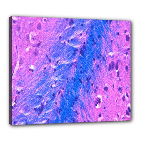 The Luxol Fast Blue Myelin Stain Canvas 24  X 20 