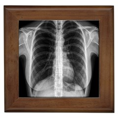 X Ray Framed Tiles by Valentinaart