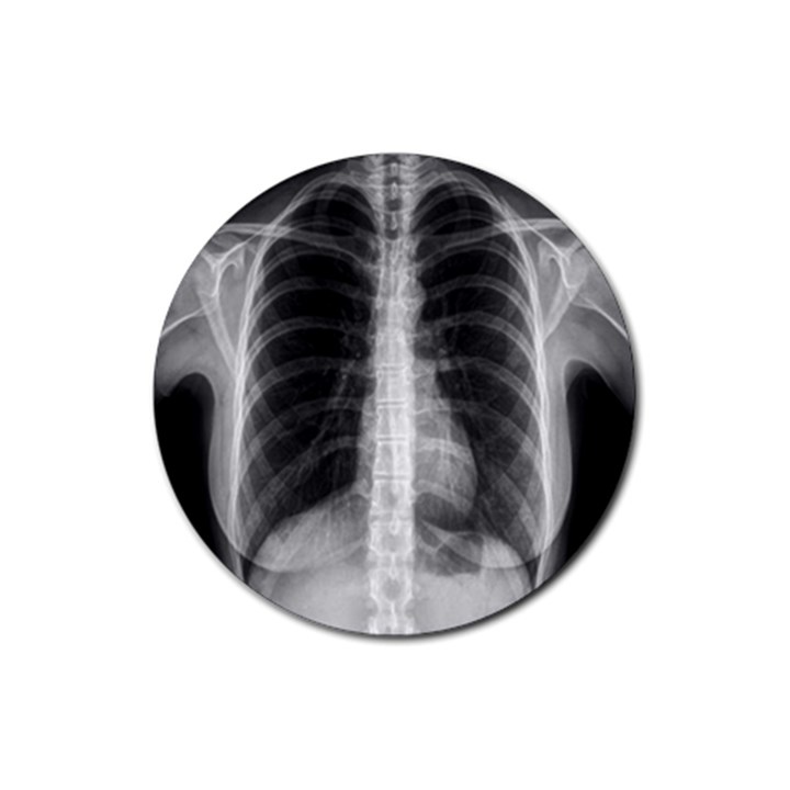 X Ray Rubber Coaster (Round) 