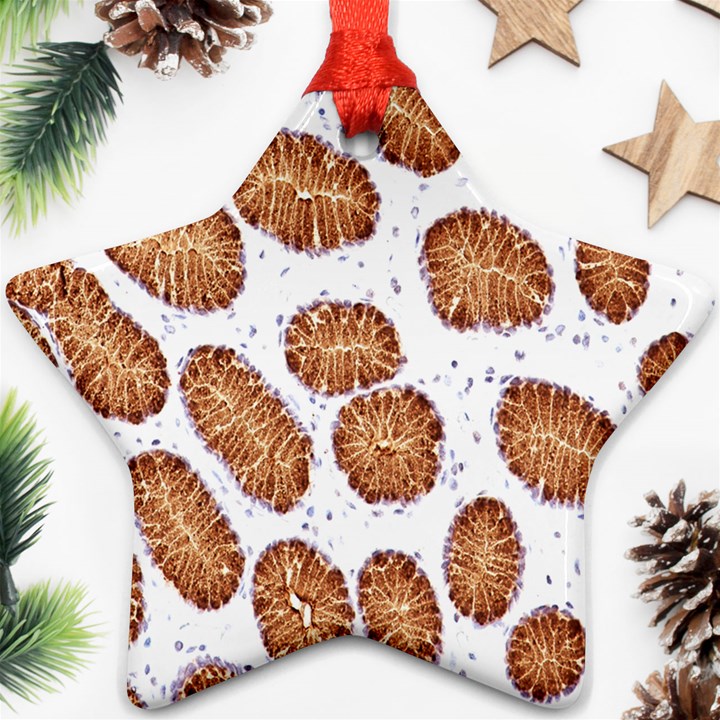 Formalin Paraffin Human Stomach Stained Bacteria Brown Ornament (Star)