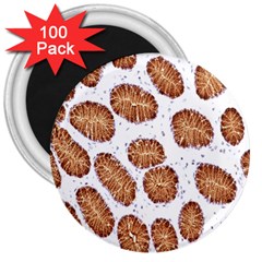 Formalin Paraffin Human Stomach Stained Bacteria Brown 3  Magnets (100 Pack)