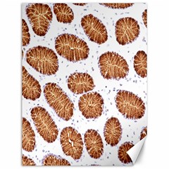 Formalin Paraffin Human Stomach Stained Bacteria Brown Canvas 12  X 16   by Mariart