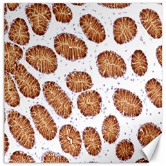 Formalin Paraffin Human Stomach Stained Bacteria Brown Canvas 16  X 16   by Mariart