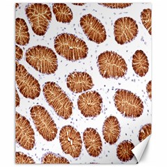 Formalin Paraffin Human Stomach Stained Bacteria Brown Canvas 20  X 24   by Mariart