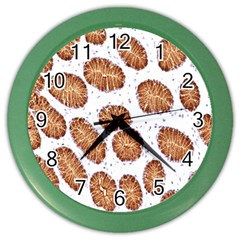 Formalin Paraffin Human Stomach Stained Bacteria Brown Color Wall Clocks by Mariart