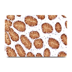 Formalin Paraffin Human Stomach Stained Bacteria Brown Plate Mats by Mariart