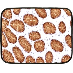 Formalin Paraffin Human Stomach Stained Bacteria Brown Fleece Blanket (mini) by Mariart