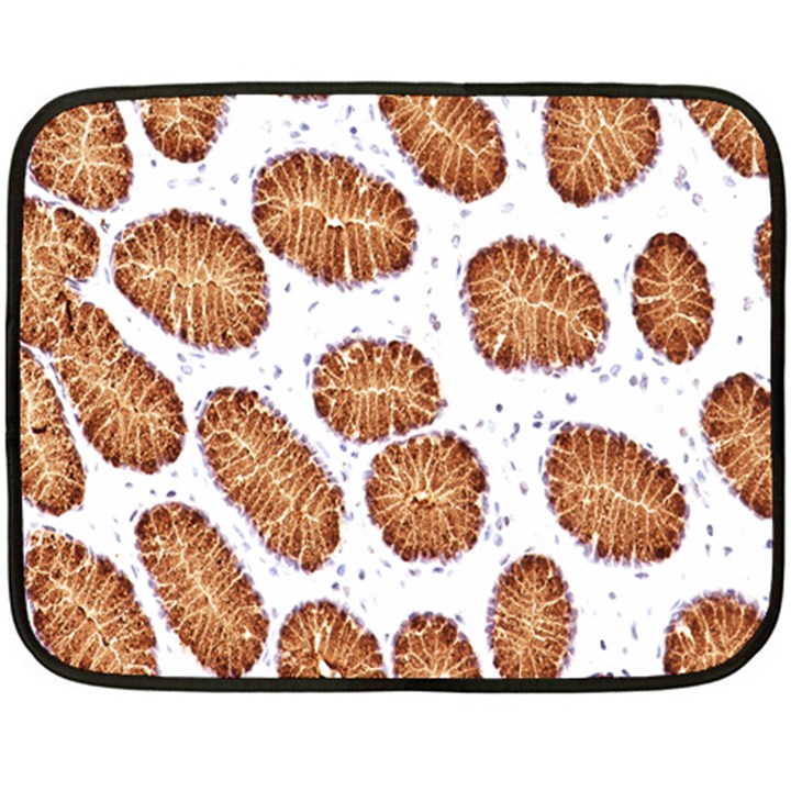 Formalin Paraffin Human Stomach Stained Bacteria Brown Fleece Blanket (Mini)