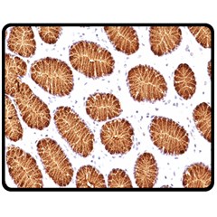 Formalin Paraffin Human Stomach Stained Bacteria Brown Fleece Blanket (medium)  by Mariart