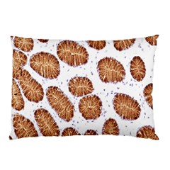 Formalin Paraffin Human Stomach Stained Bacteria Brown Pillow Case (two Sides) by Mariart