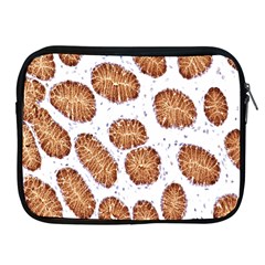 Formalin Paraffin Human Stomach Stained Bacteria Brown Apple Ipad 2/3/4 Zipper Cases by Mariart