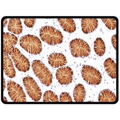 Formalin Paraffin Human Stomach Stained Bacteria Brown Double Sided Fleece Blanket (large)  by Mariart