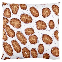 Formalin Paraffin Human Stomach Stained Bacteria Brown Standard Flano Cushion Case (one Side) by Mariart