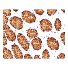 Formalin Paraffin Human Stomach Stained Bacteria Brown Double Sided Flano Blanket (large)  by Mariart