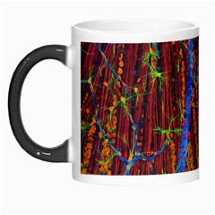 Neurobiology Morph Mugs by BangZart