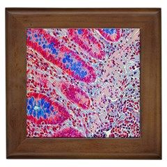 Histology Inc Histo Logistics Incorporated Alcian Blue Framed Tiles by Mariart