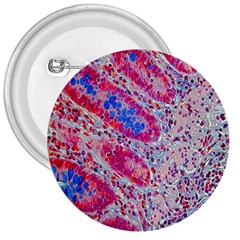 Histology Inc Histo Logistics Incorporated Alcian Blue 3  Buttons by Mariart