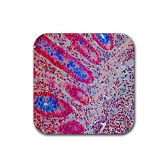 Histology Inc Histo Logistics Incorporated Alcian Blue Rubber Coaster (square) 