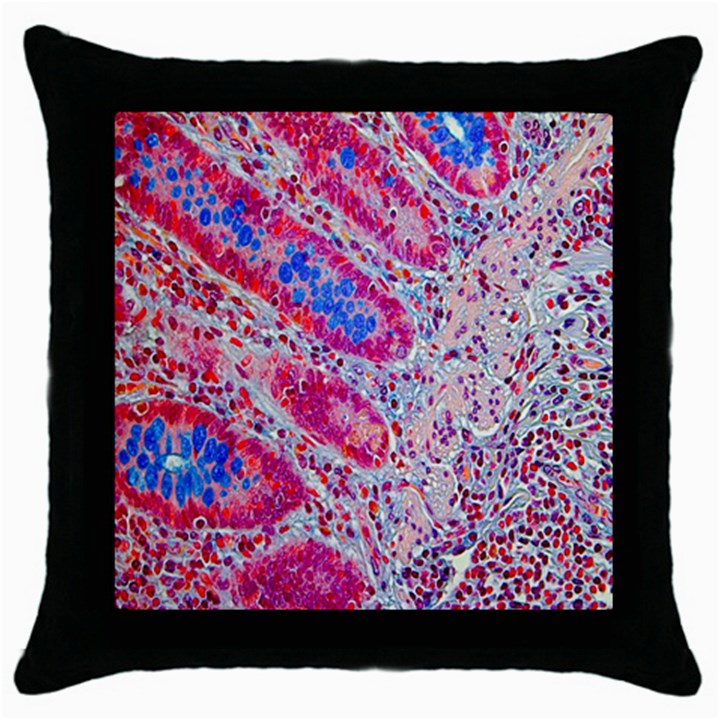 Histology Inc Histo Logistics Incorporated Alcian Blue Throw Pillow Case (Black)