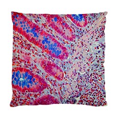 Histology Inc Histo Logistics Incorporated Alcian Blue Standard Cushion Case (two Sides) by Mariart