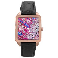 Histology Inc Histo Logistics Incorporated Alcian Blue Rose Gold Leather Watch  by Mariart