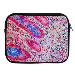 Histology Inc Histo Logistics Incorporated Alcian Blue Apple Ipad 2/3/4 Zipper Cases by Mariart