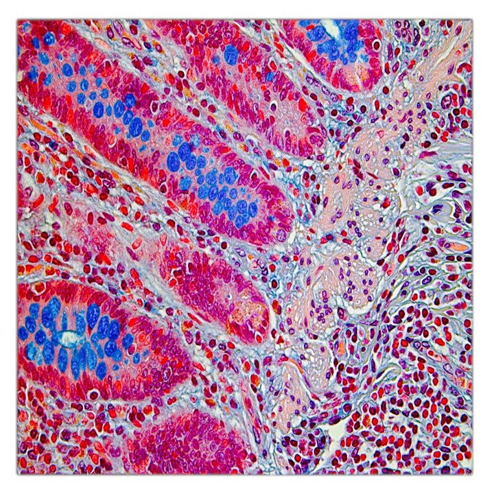 Histology Inc Histo Logistics Incorporated Alcian Blue Large Satin Scarf (Square)