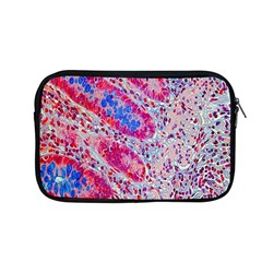 Histology Inc Histo Logistics Incorporated Alcian Blue Apple Macbook Pro 13  Zipper Case by Mariart