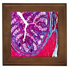 Histology Inc Histo Logistics Incorporated Masson s Trichrome Three Colour Staining Framed Tiles by Mariart