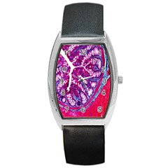 Histology Inc Histo Logistics Incorporated Masson s Trichrome Three Colour Staining Barrel Style Metal Watch by Mariart