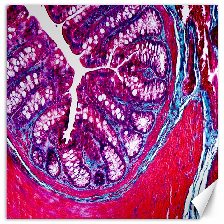 Histology Inc Histo Logistics Incorporated Masson s Trichrome Three Colour Staining Canvas 20  x 20  