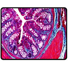 Histology Inc Histo Logistics Incorporated Masson s Trichrome Three Colour Staining Fleece Blanket (medium)  by Mariart