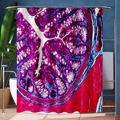 Histology Inc Histo Logistics Incorporated Masson s Trichrome Three Colour Staining Shower Curtain 60  X 72  (medium)  by Mariart