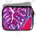 Histology Inc Histo Logistics Incorporated Masson s Trichrome Three Colour Staining Apple iPad 2/3/4 Zipper Cases Front